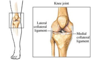 Lateral Collateral